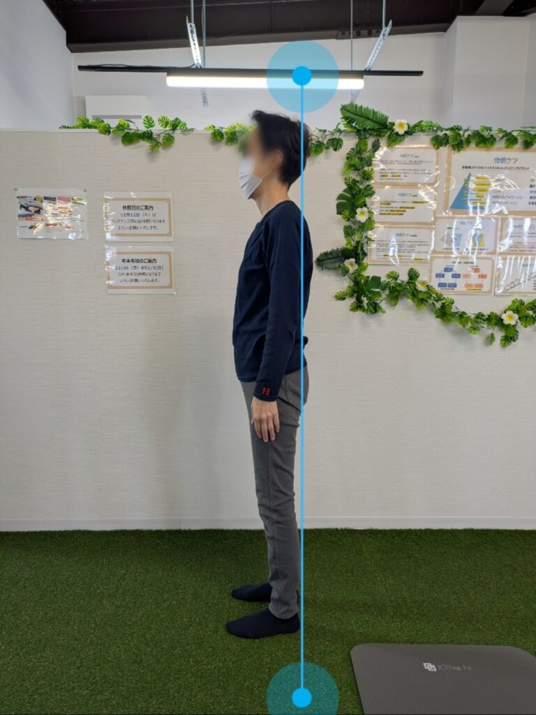 Before-After 20251218