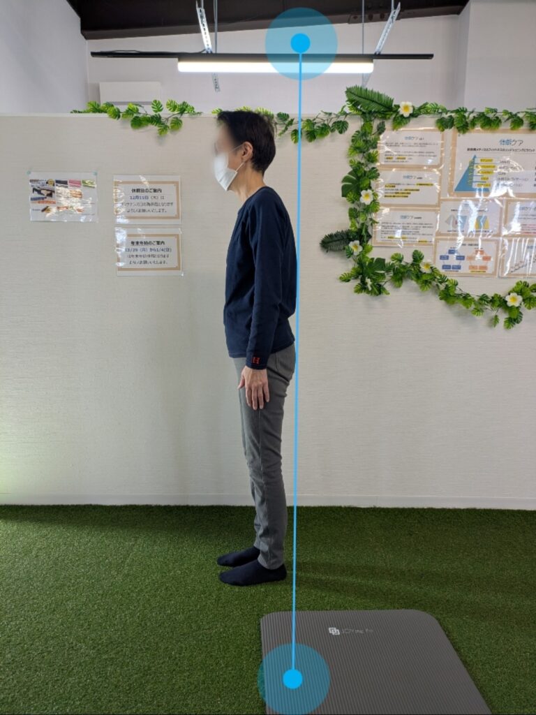 Before-After 20251218